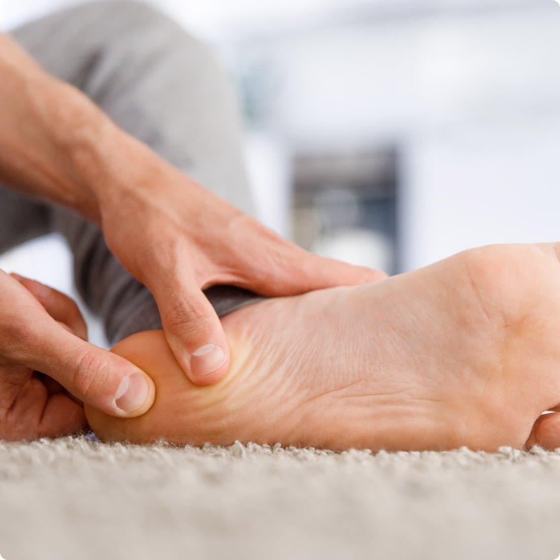 plantar fasciitis